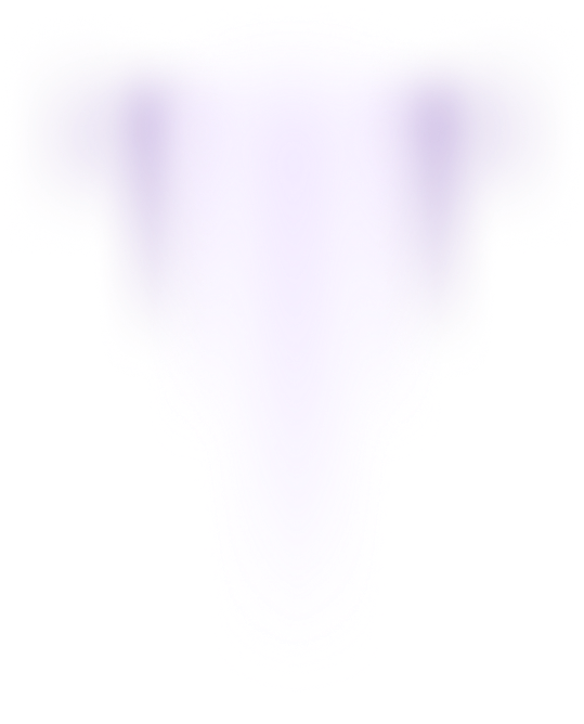 Element2